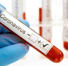 थप सात हजार ४ सय ४८ जना कोरोना भाइरस सङ्क्रमित